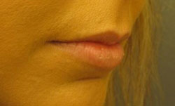 Before and After Results