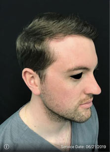 Patient After Procedure