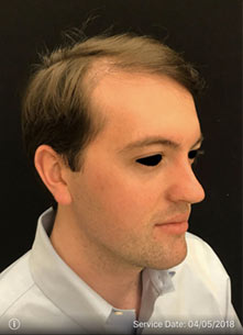 Patient Before Procedure